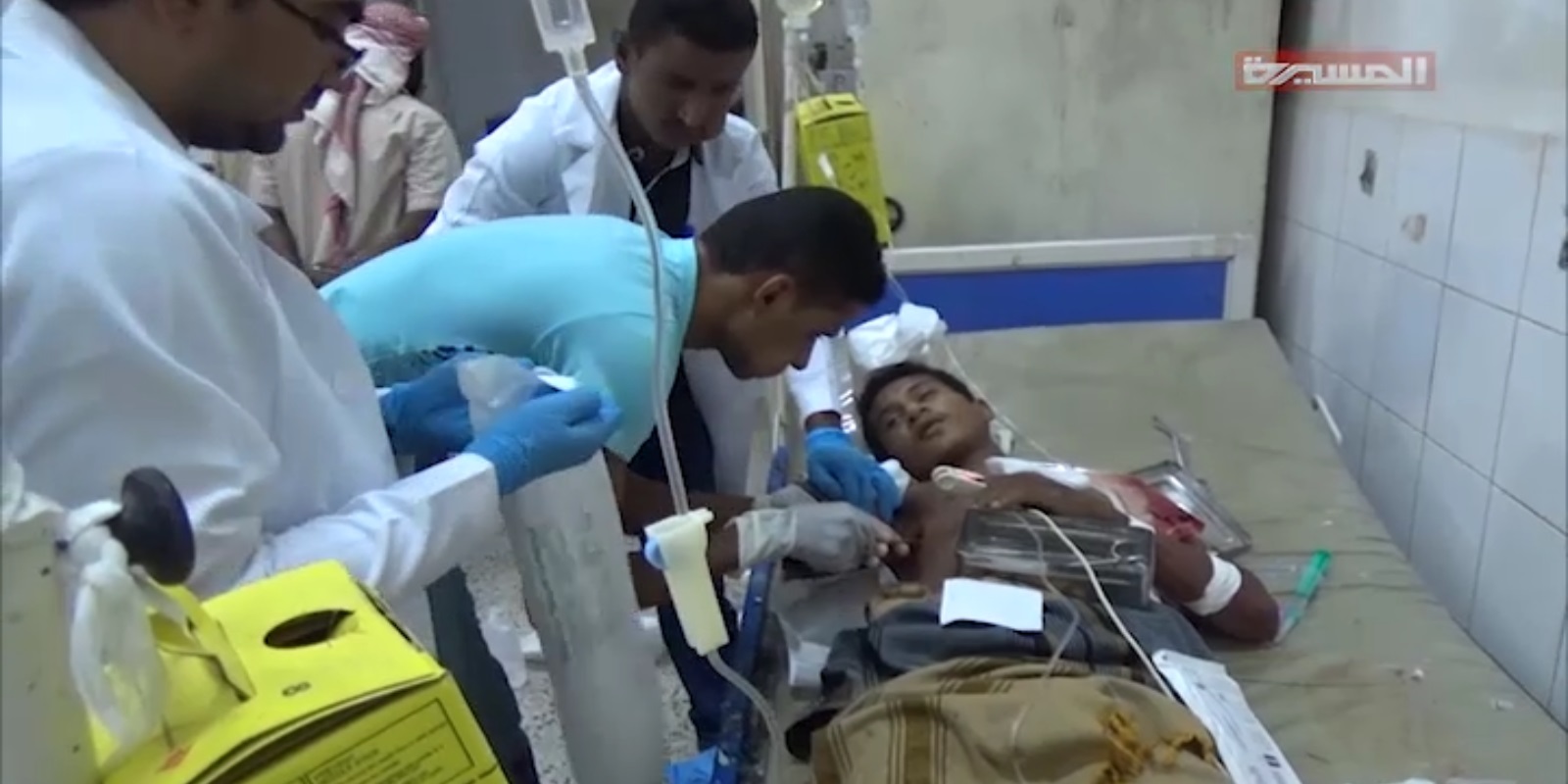 بتر يد أحد المواطنين جراء غارة على السويق بالتحيتا بمحافظة الحديدة