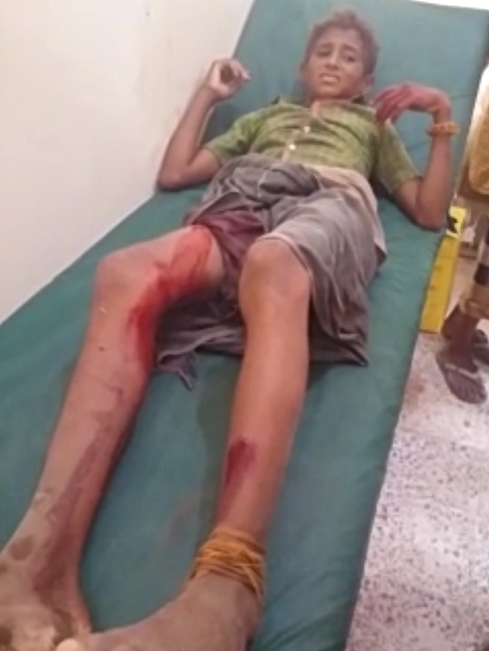 جريمة استهداف مستشفى الدريهمي وجرح العديد من المواطنين14-10-2018