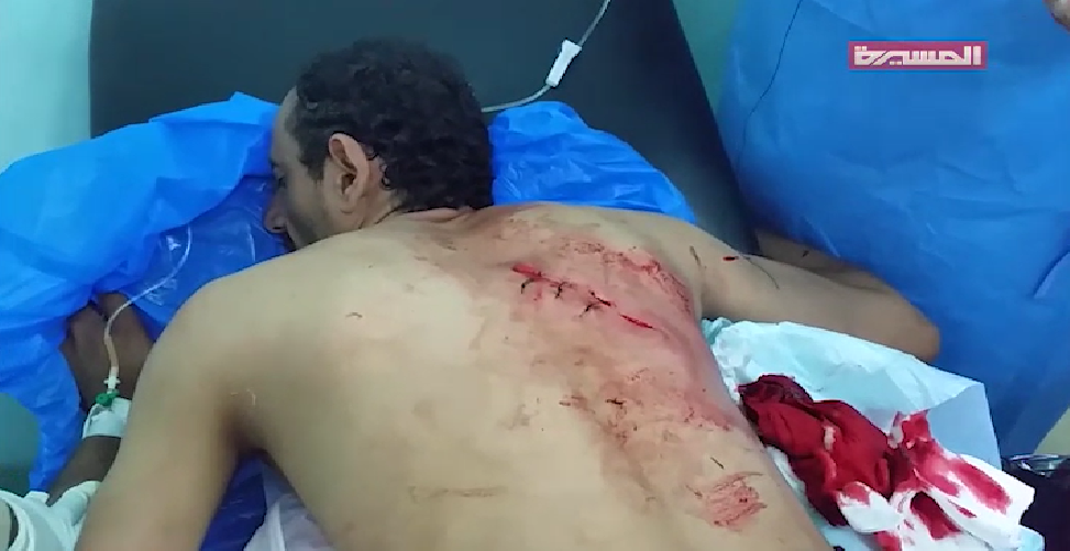 إصابة مزارع بجروح في غارة على مزرعة في مفرق باقم بصعدة 27-08-2018
