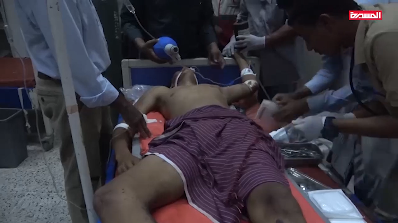 شاهد – جرح مواطن بإنفجار أحد مخلفات العدوان بمحافظة الحديدة 18-10-2019