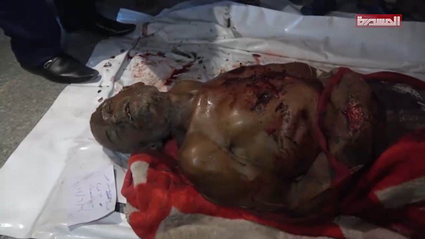 جريمة للعدوان وشهداء وجرحى في مدينة الحديدة  07-06-2019