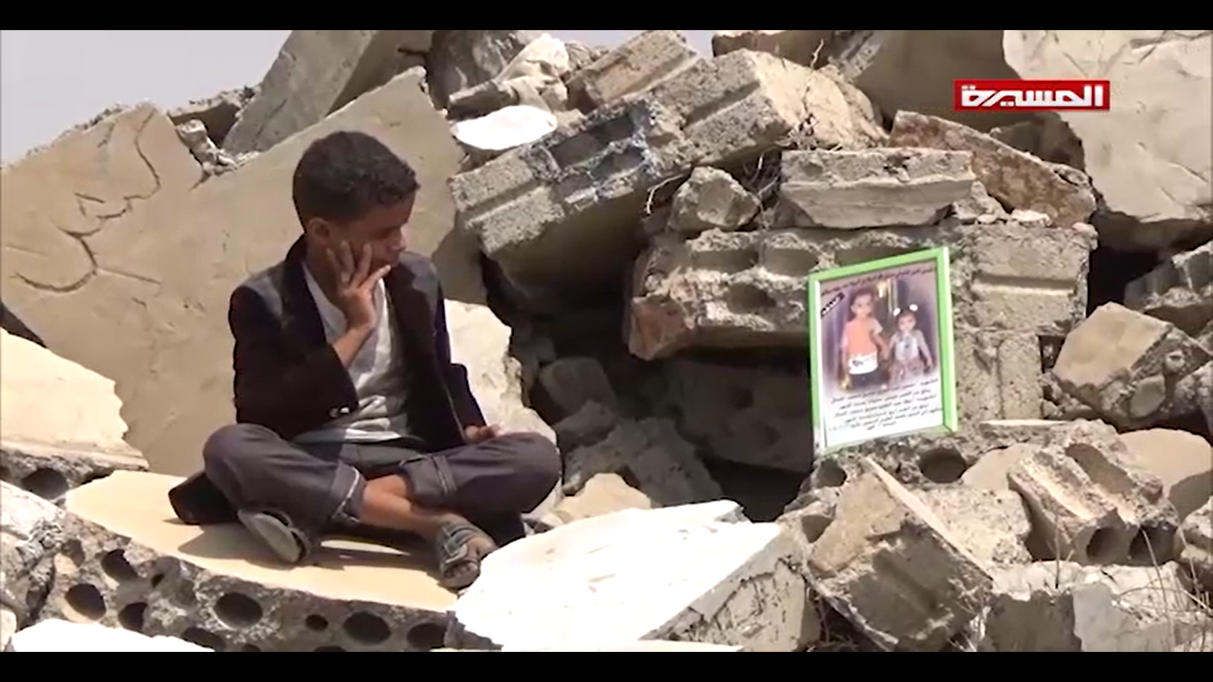 أطفال اليمن ضحايا جرائم العدوان السعودي الأمريكي 05-03-2019