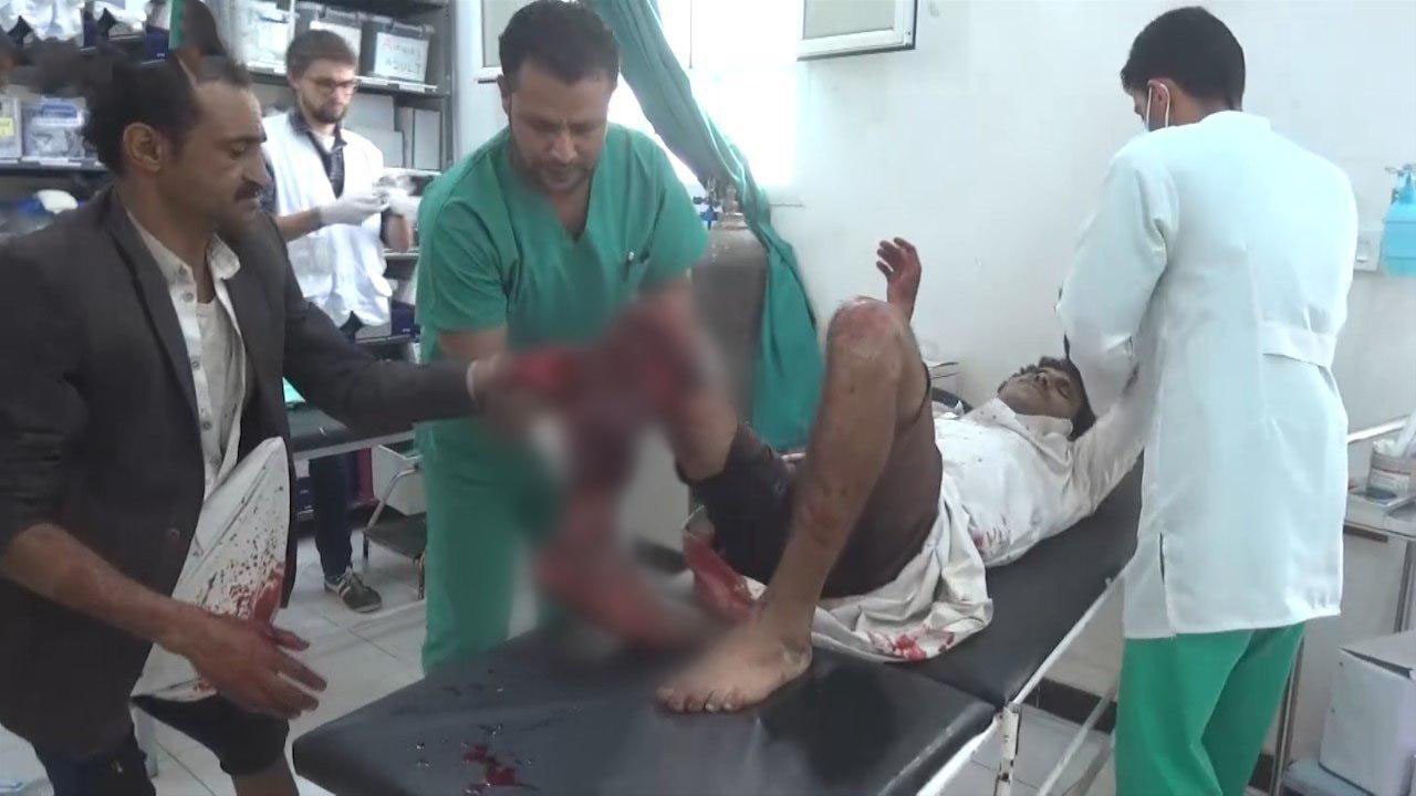 مشاهد من جريمة العدوان في منطقة مران بمحافظة صعدة في أول أيام عيد الفطر