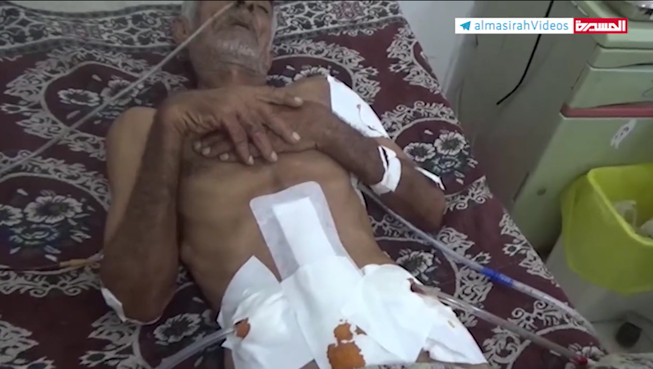 الحديدة – جريمة مرتزقة العدوان على المواطنيين في الجاح 11-08-2020