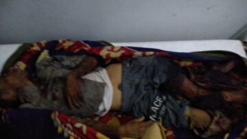 استشهاد وإصابة 17 مواطناً في مجزرة بشعة لمرتزقة العدوان في مقبنة بتعز